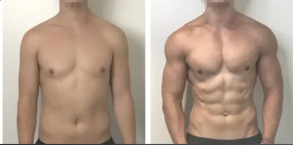 Brandon L, before and after