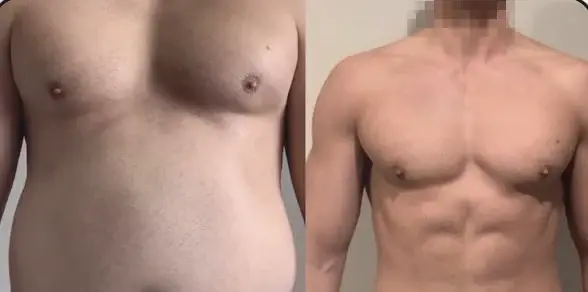 Tyler J, before and after